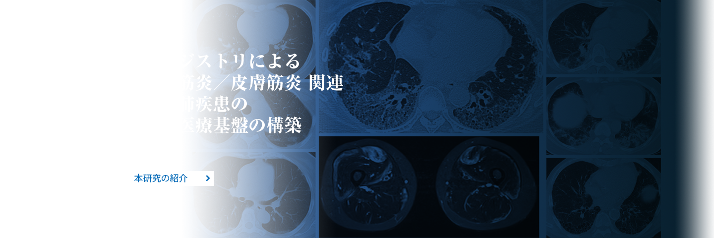 統合レジストリによる多発性筋炎／皮膚筋炎 イメージ画像